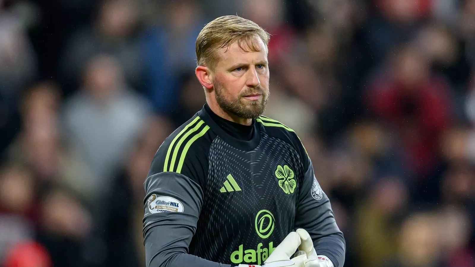 O'Neill surprised by Schmeichel's surgery announcement
